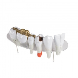 Erler-Zimmer 10x Enlarged Anatomy Model for Dental Morphology